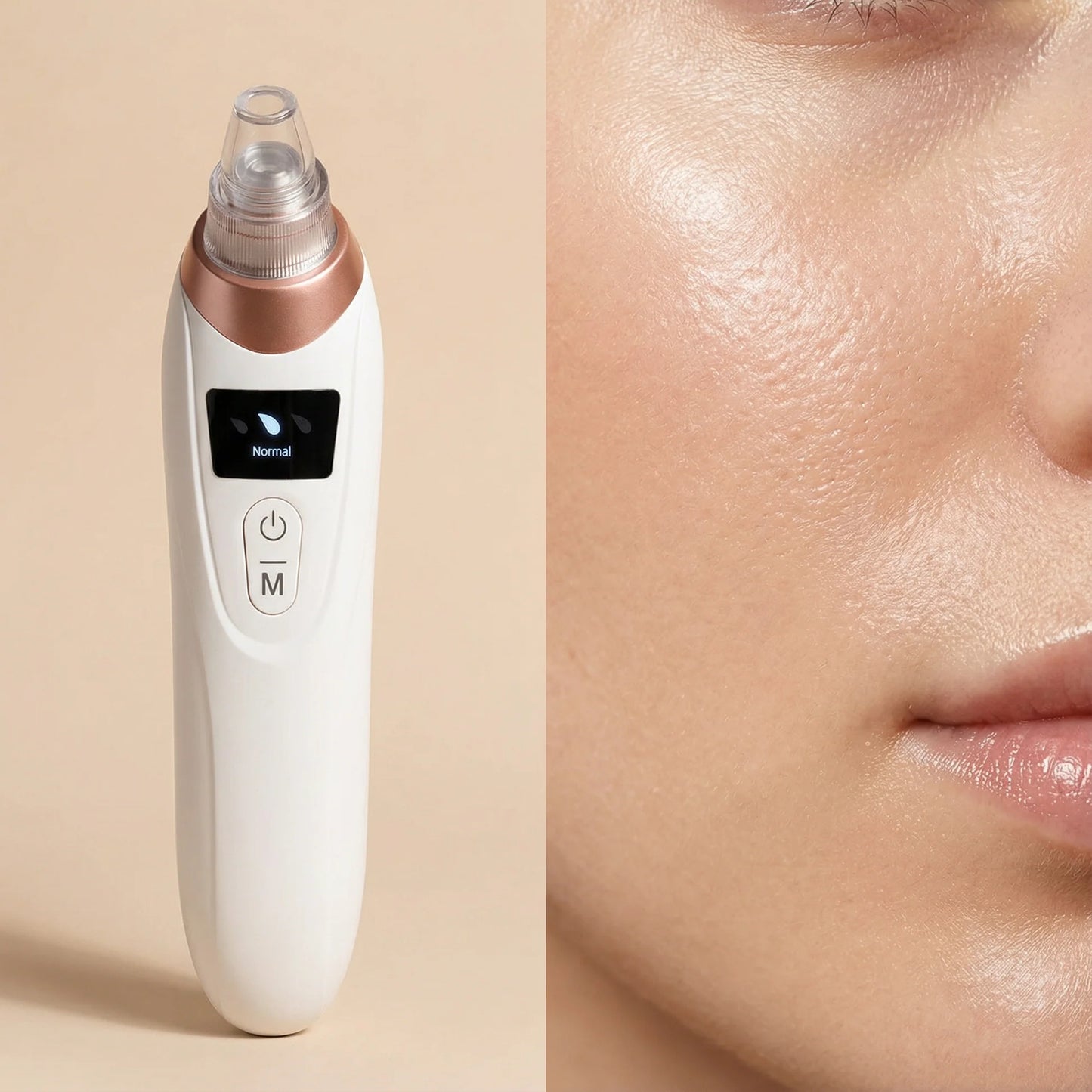 ®Oligama Pro – Siyah Nokta ve Gözenek Temizleme Cihazı